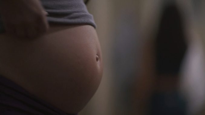 Ultrasound.2021 (4)